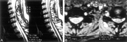 Fig 1.