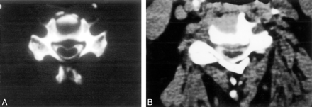Fig 2.