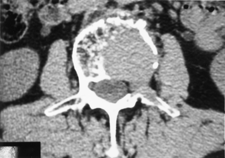 Fig 1.