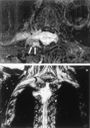Fig 1.