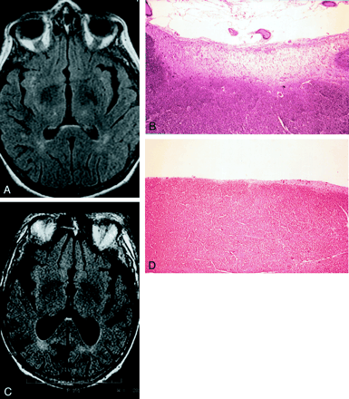Fig 3.