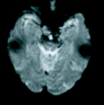 Fig 1.