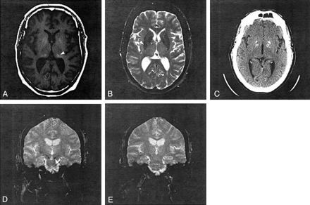 Fig 1.