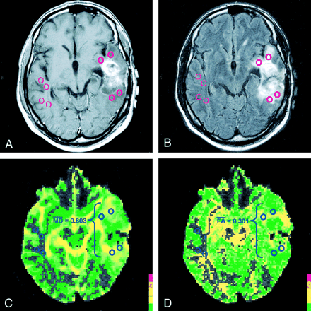 Fig 3.