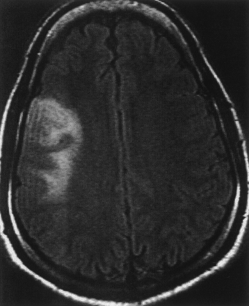 Fig 1.