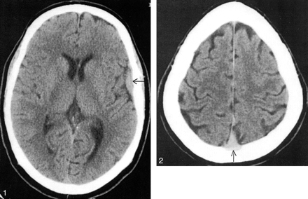 Fig 2.