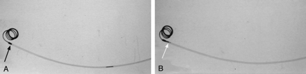 Fig 4.