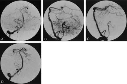 Fig 3.