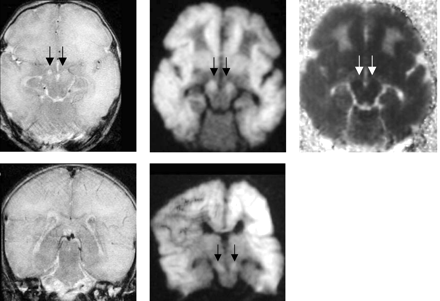 Fig 4.