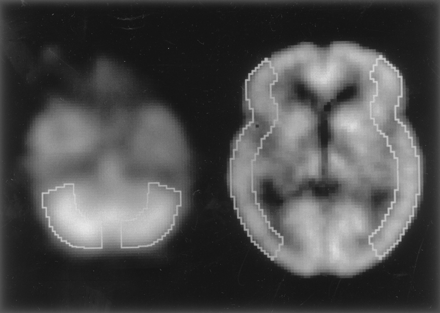 Fig 1.