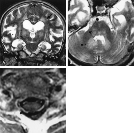 Fig 5.
