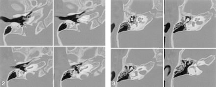 Fig 2.