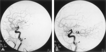 Fig 2.