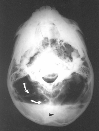 Fig 3.