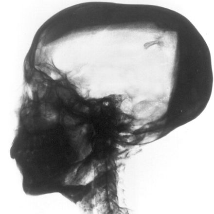 Fig 4.