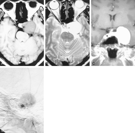 Fig 1.