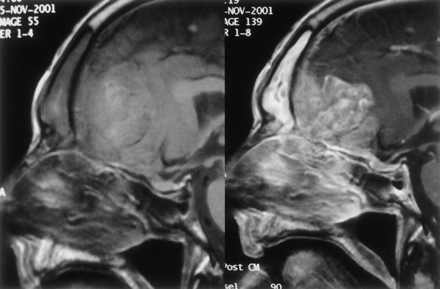 Fig 2.
