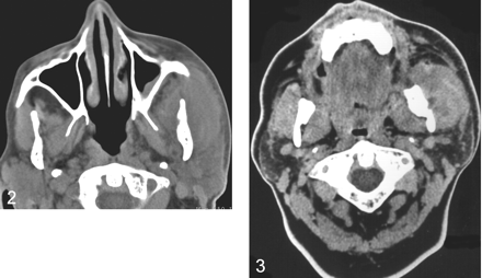 Fig 2.