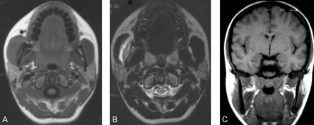 Fig 4.