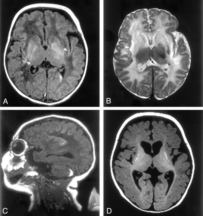 Fig 1.
