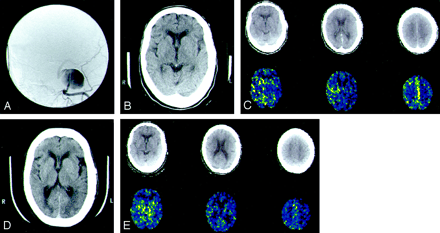 Fig 3.