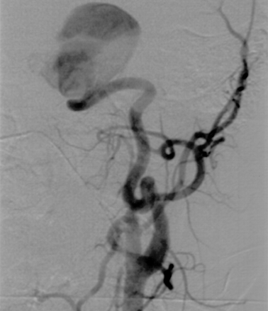 Fig 1.