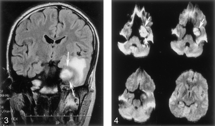 Fig 3.