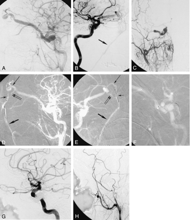 Fig 1.