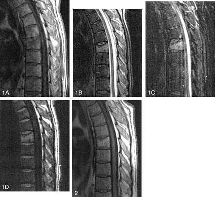 Fig 2.