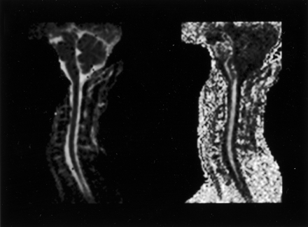 Fig 1.