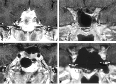 Fig 5.