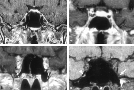Fig 8.
