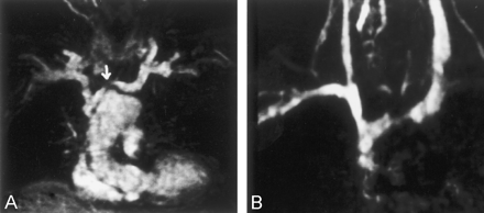 Fig 5.