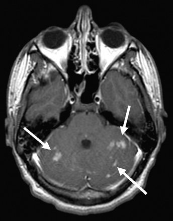 Fig 3.