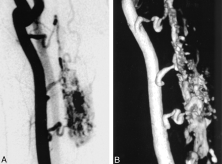 Fig 3.