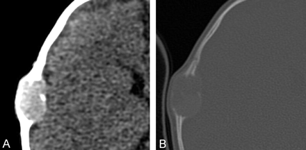 Fig 2.