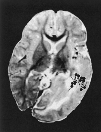 Fig 3.