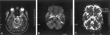 Fig 2.
