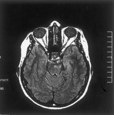 Fig 3.