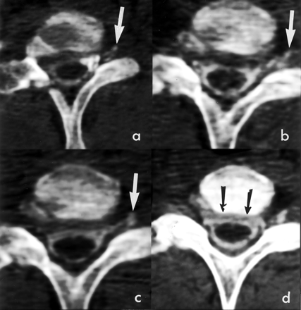 Fig 3.