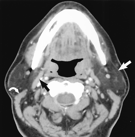 Fig 2.