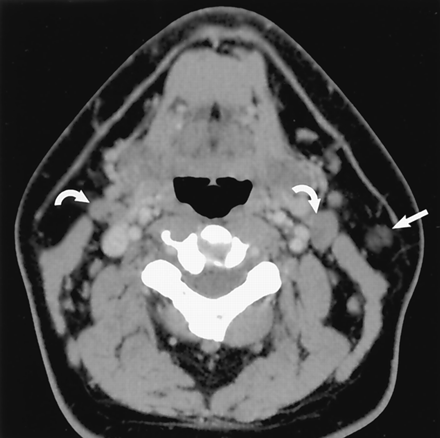 Fig 3.
