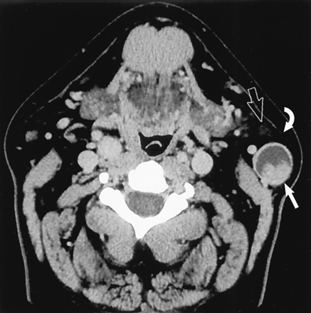 Fig 4.
