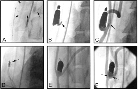 Fig 2.