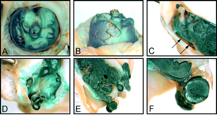 Fig 3.