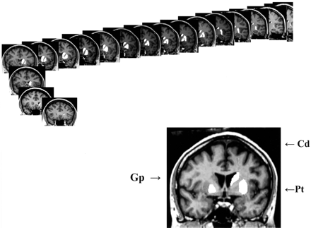 Fig 1.