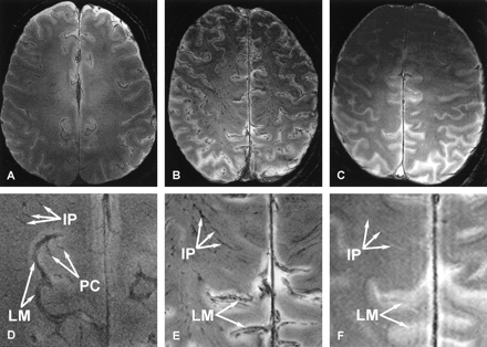 Fig 1.