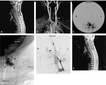 Fig 1.
