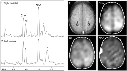 Fig 3.