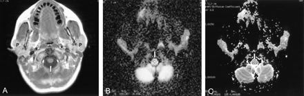 Fig 2.